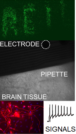 The Regenerative Electrode Interface Lab (REIL) is spelled out using genetically engineered cells in the top panel. It studies the interface between brain tissue and implanted electrodes (middle panel) using cutting-edge techniques in cellular reprogramming and electrophysiology (bottom panels).