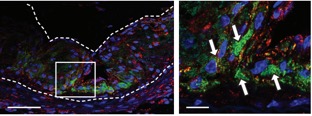 In this image, the dotted line outlines the atherosclerotic artery in a mouse; the green represents nanoparticles in the plaque, and red indicates macrophages that the nanoparticles are stimulating to eat the debris.