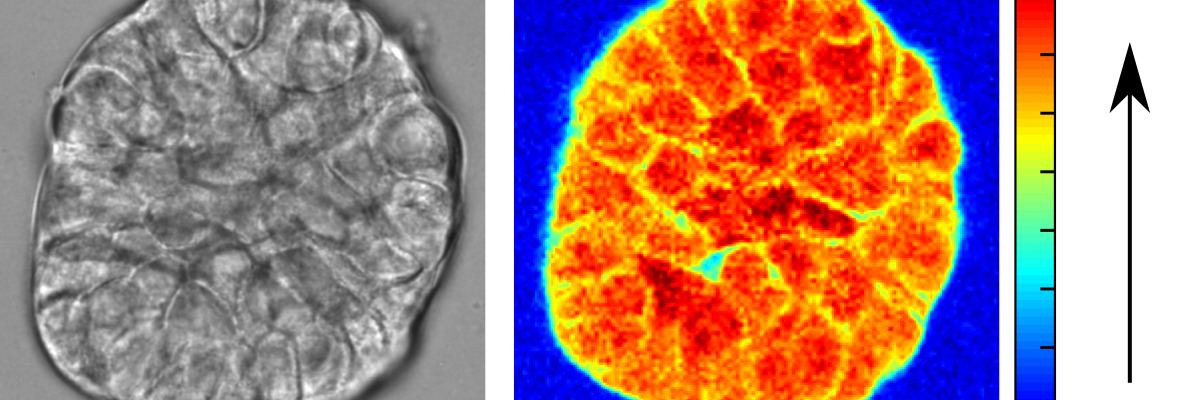 bright-field image of a cell cluster and the corresponding stiffness map acquired by Brillouin microscopy