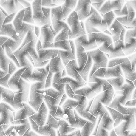 Real-time optical microscopy of in-situ surface roughening of hydrogel during swelling (Caroline Szczepanski)​