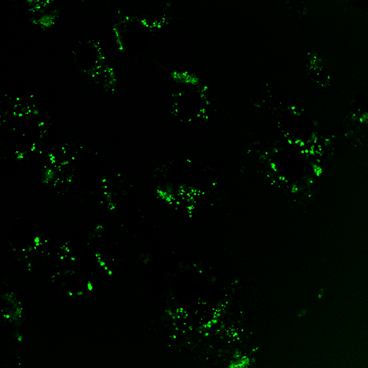 Fluorescence microscopy images comparing the activation of wild-type (WT) and mutant (W457A) IRE1alpha protein cultured in bovine serum albumin (BSA, control) vs. in palmitic acid (PA). WT shows sparse green spots in BSA and numerous green spots with PA, indicating that PA induces the activation of the protein. The W457A variant shows no fluorescence with either BSA or PA, suggesting the tryptophan residue (W) in the protein is important for the activation of protein. (Kris Chan)​