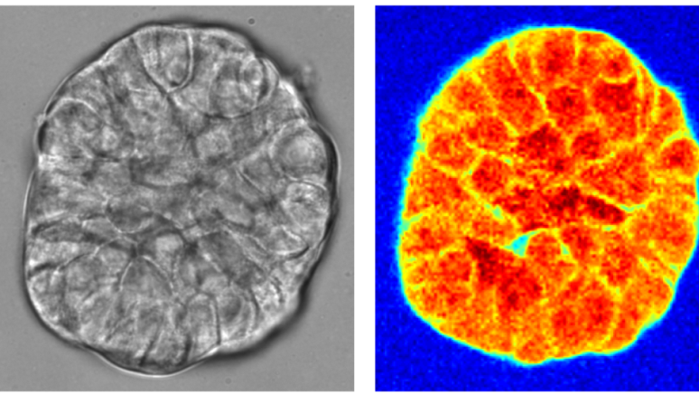 Research Spotlight: New mechanical testing reveals how breast cancer morphs from a single cell to a cluster