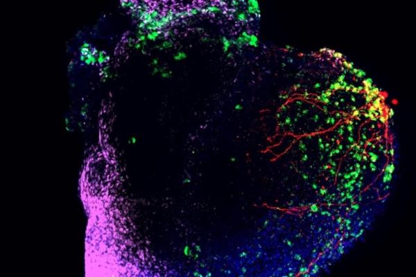 Spartan research makes medical breakthroughs happen