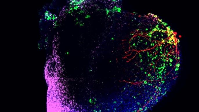 Spartan research makes medical breakthroughs happen
