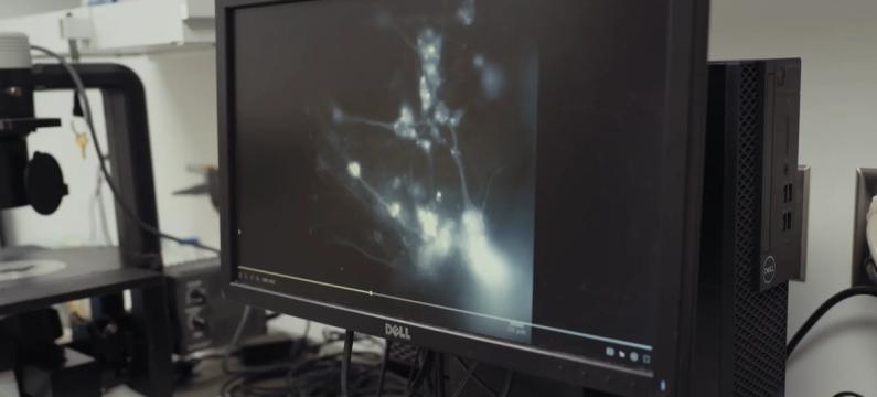 How mini hearts could help transform how we treat heart disease