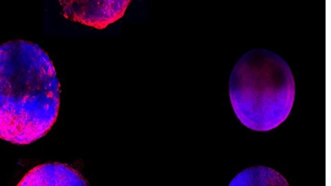 A biomedical engineering first