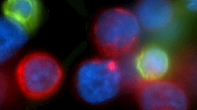 ​​​​​​​Working to stop the spread of breast cancer