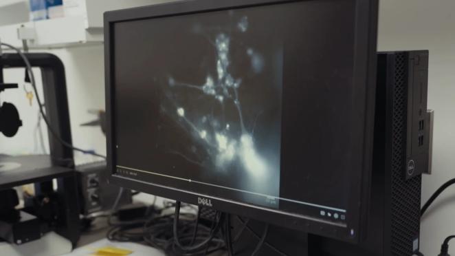 How mini hearts could help transform how we treat heart disease
