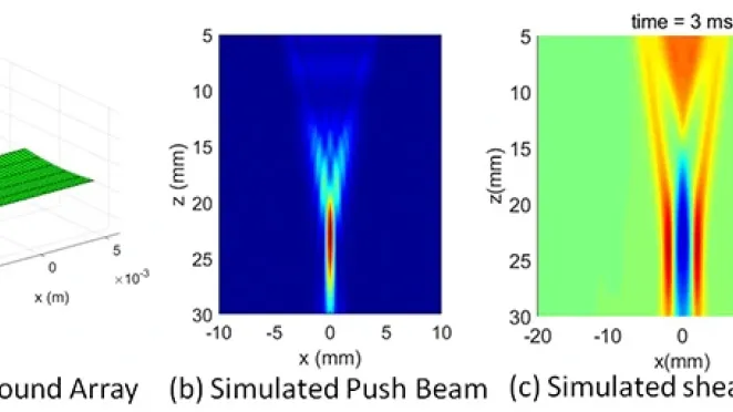 Advancing ultrasound