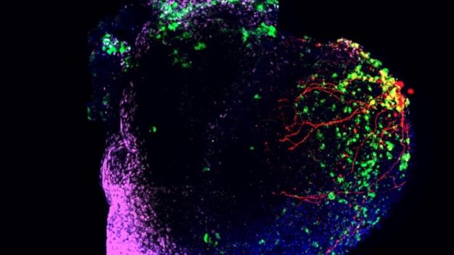 Spartan research makes medical breakthroughs happen